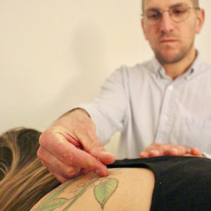 Acupuncture being performed on shoulder